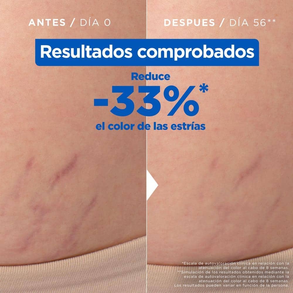 aceite-antiestrias